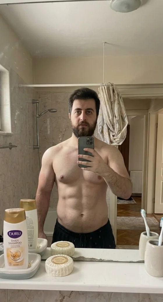 Progress photo, today